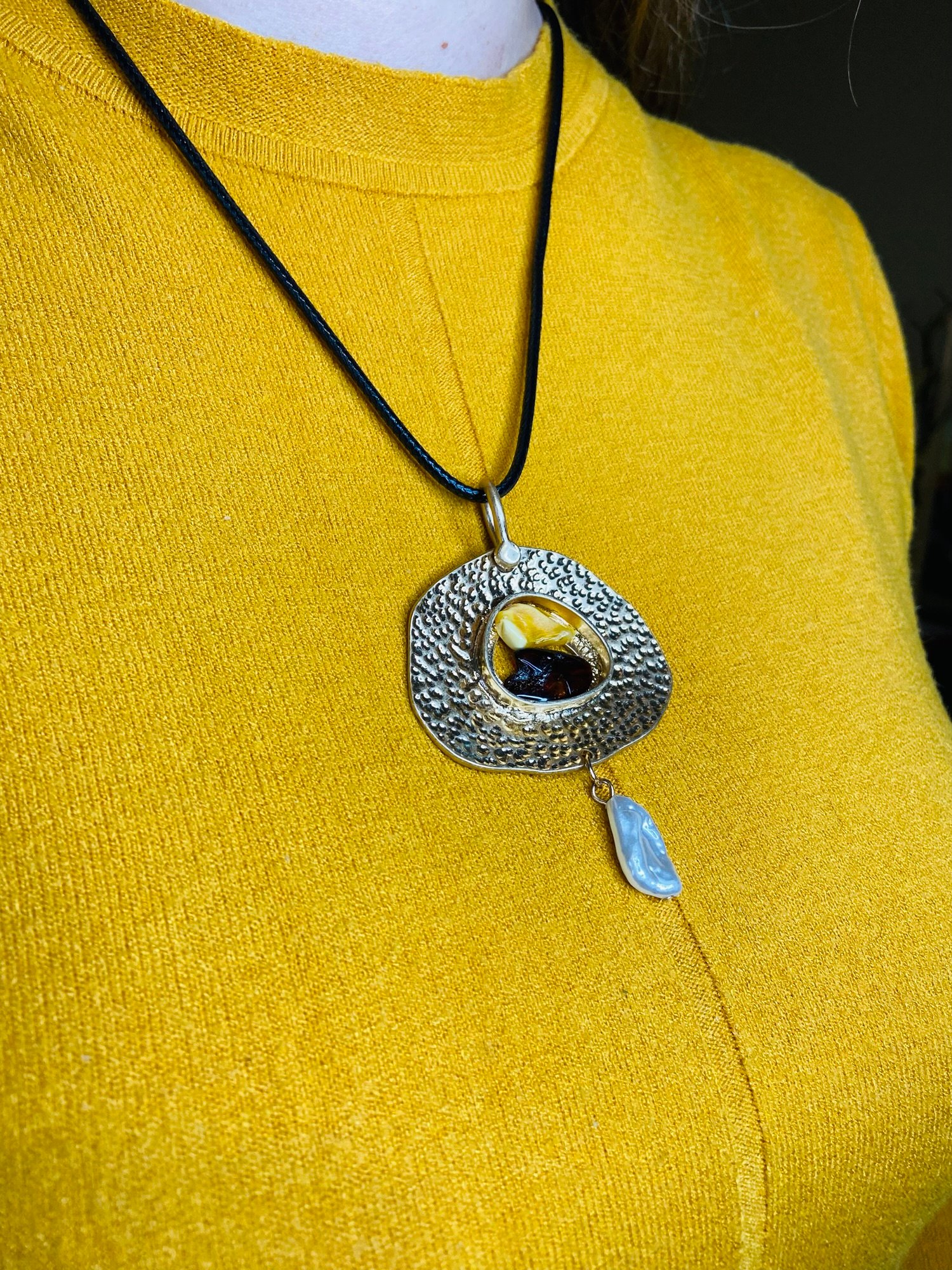 Graciozs Baltijas Dzintara medaljons ar medicīnisko metālu